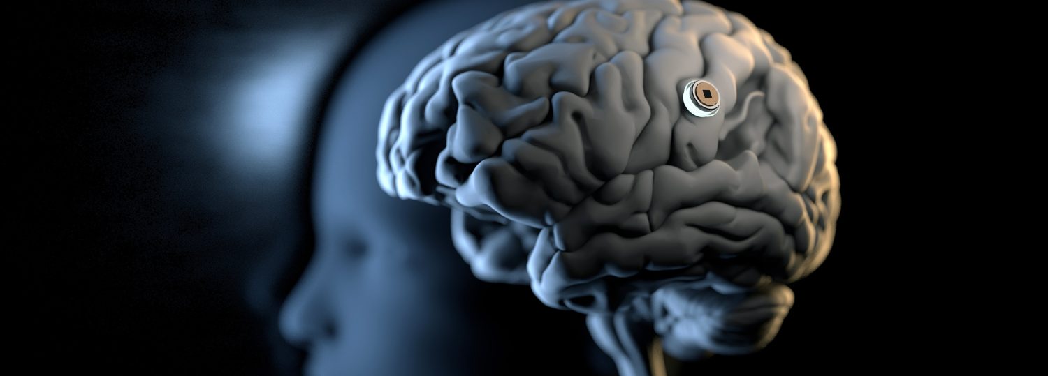 A human brain with a device embedded in it