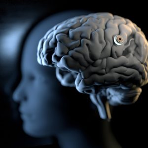 Are we Ready for Computer Chips in our Brains?