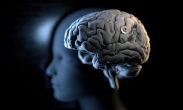 A human brain with a device embedded in it